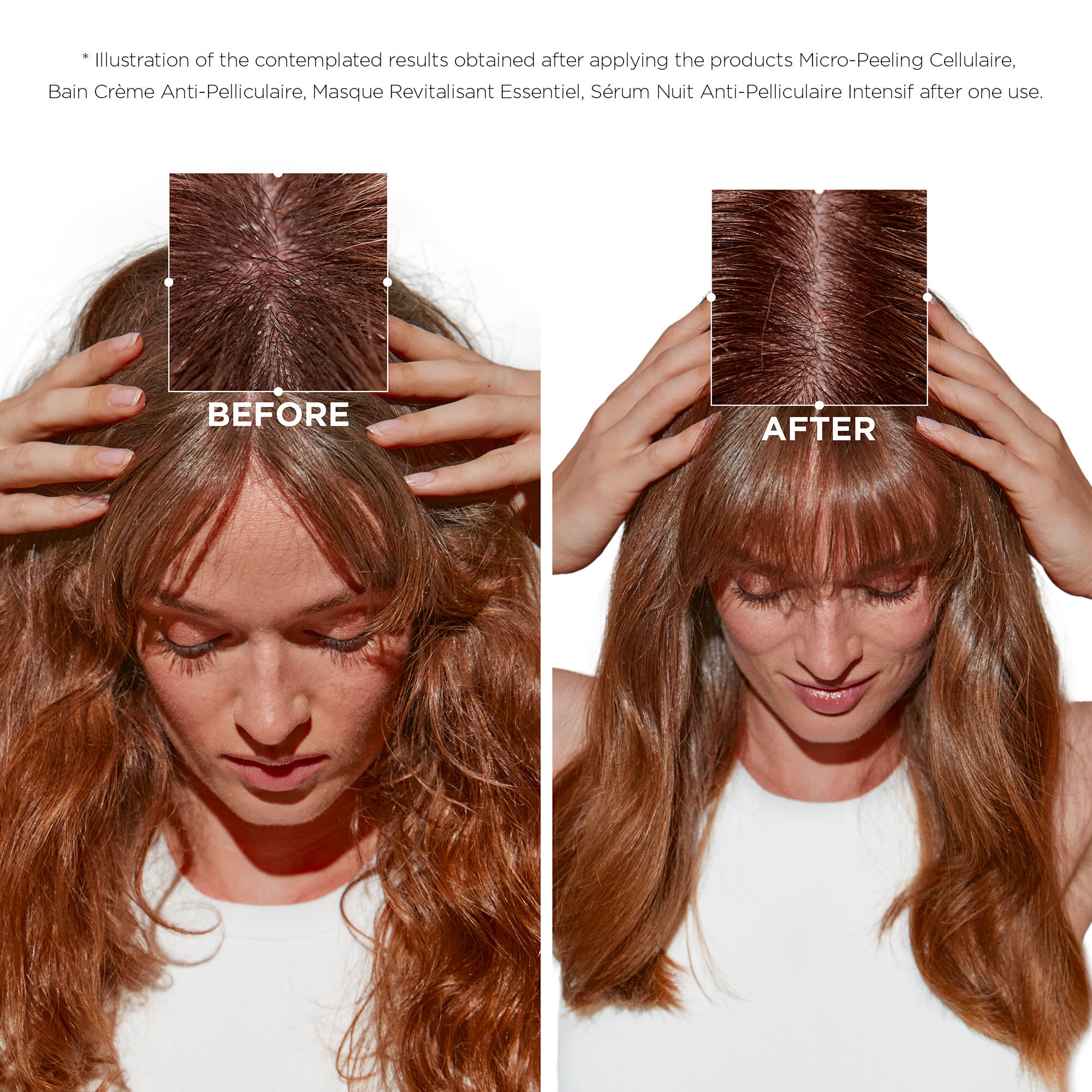 سيمبيوز ماسك منعش للشعر المعرّض للقشرة