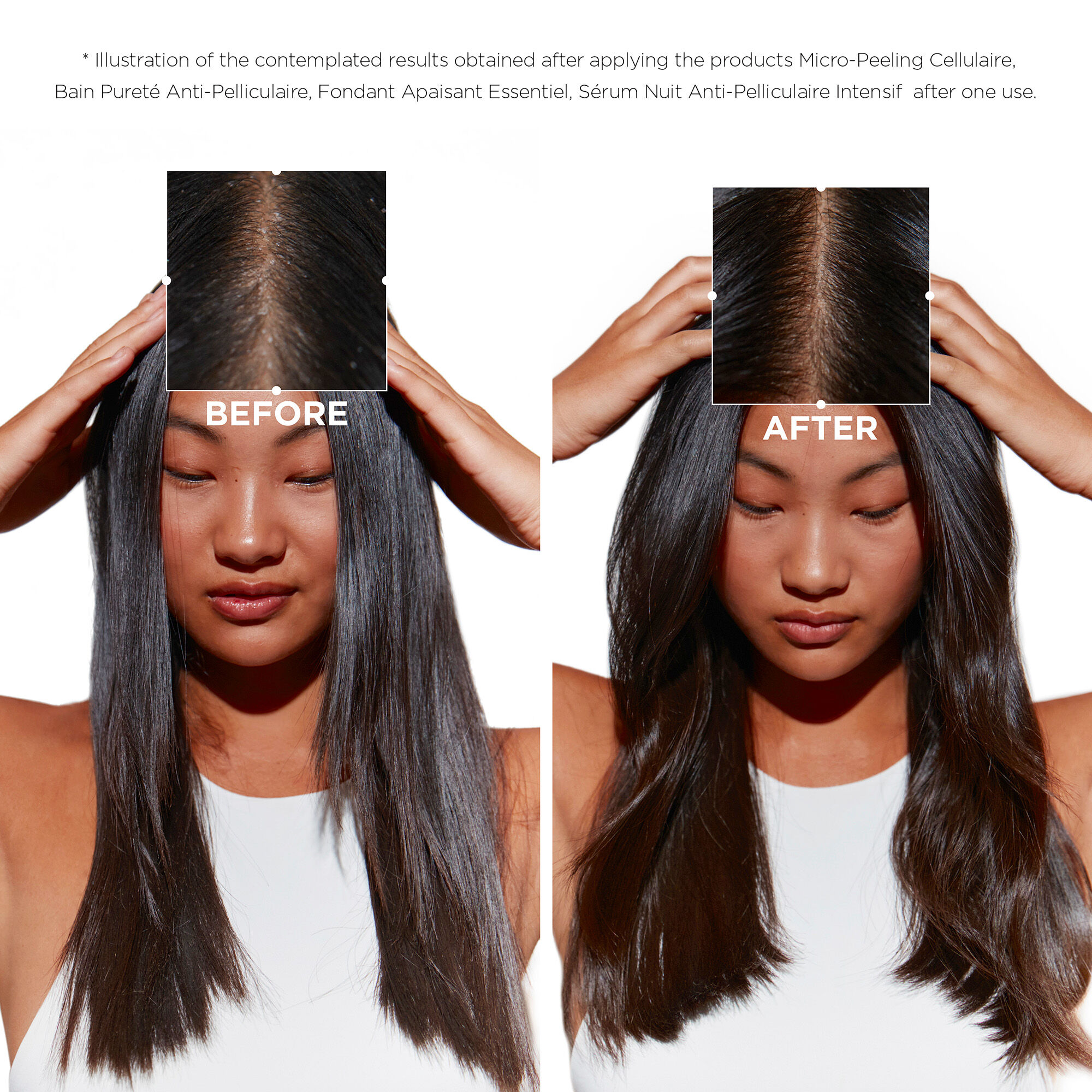 سيمبيوز بلسم ملطف للشعر المعرّض للقشرة.