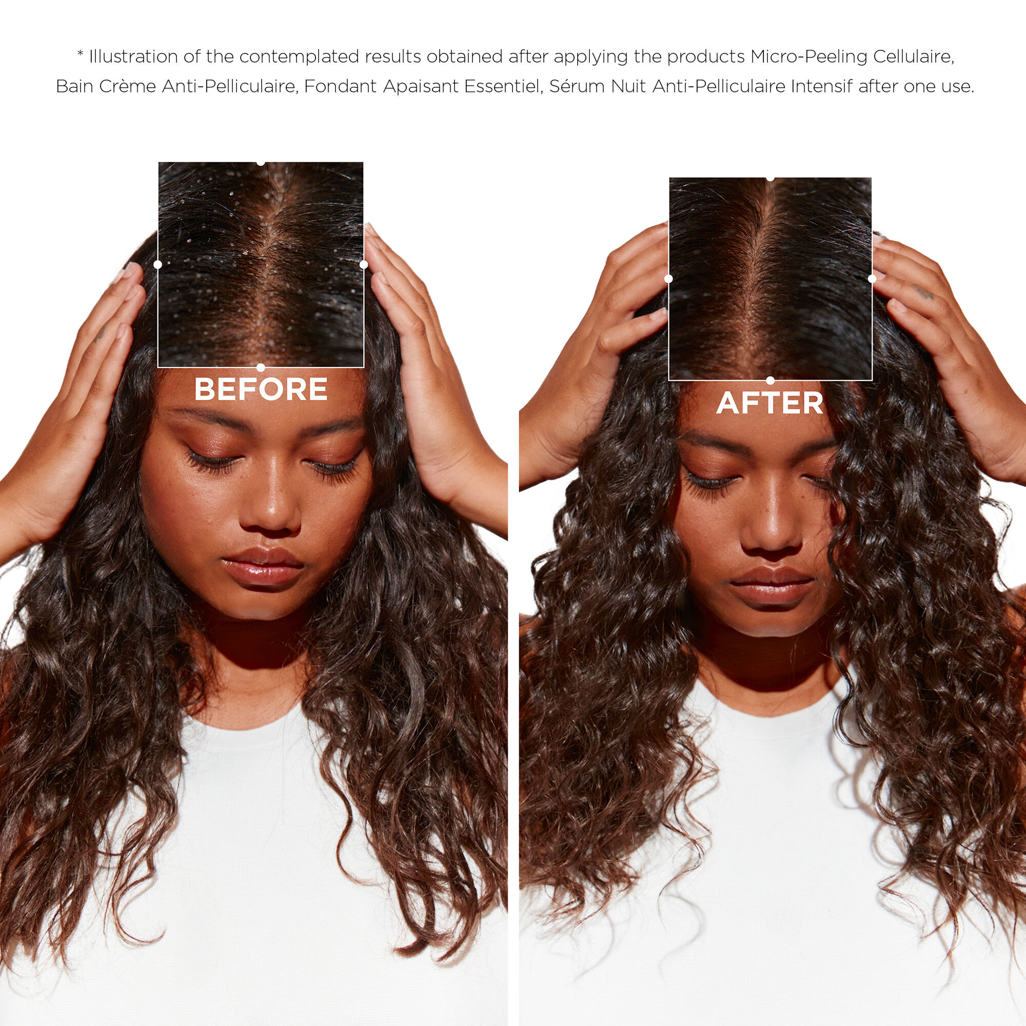 سيمبيوز شامبو مرطّب ومضاد للقشرة